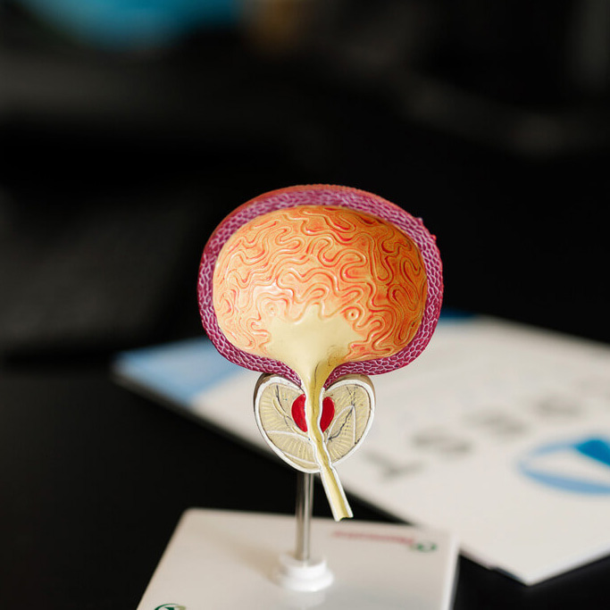 model of a bladder and prostate